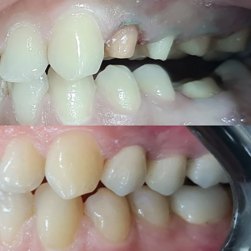 Фото слайдера: Dentcare dental clinic