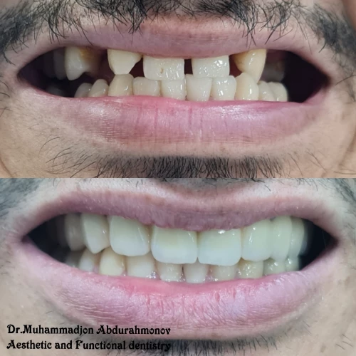 Фото слайдера: Dentcare dental clinic
