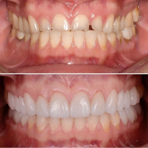 Фото слайдера: Dentcare dental clinic