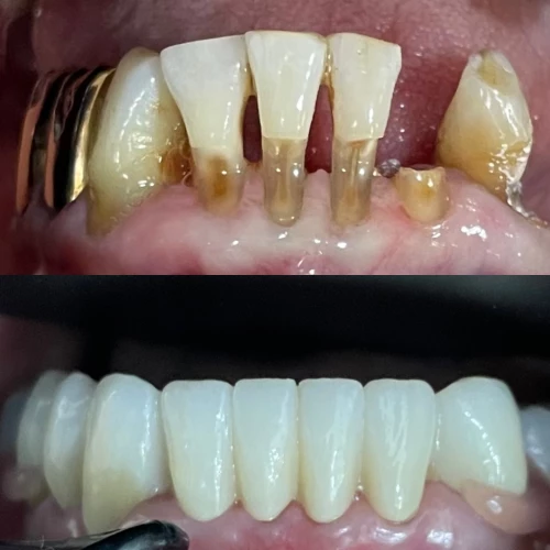 Фото слайдера: Dentcare dental clinic
