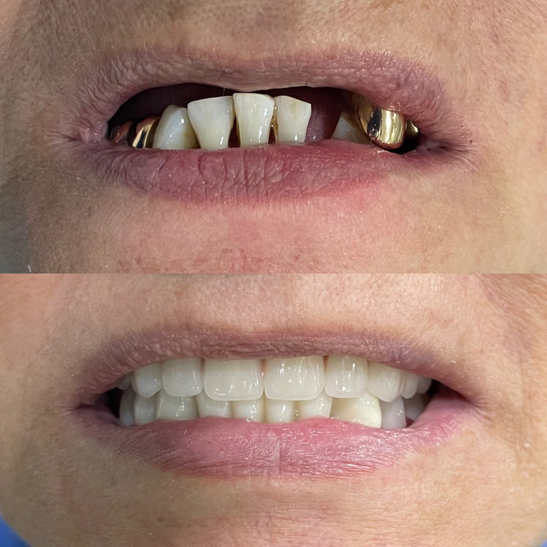 Фото слайдера: Dentcare dental clinic. Стоматологи-хирурги