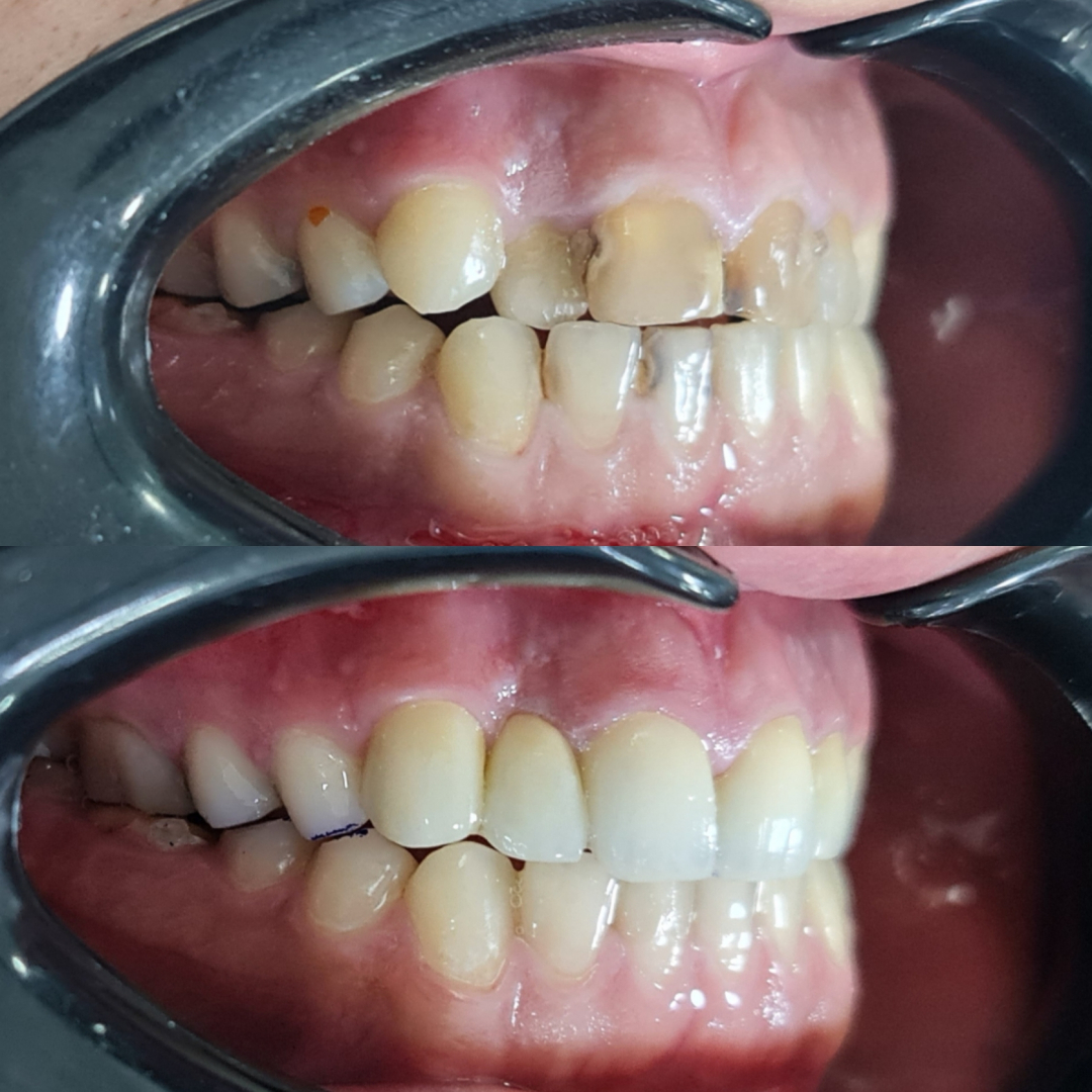 Фото слайдера: Dentcare dental clinic. Стоматологи-хирурги