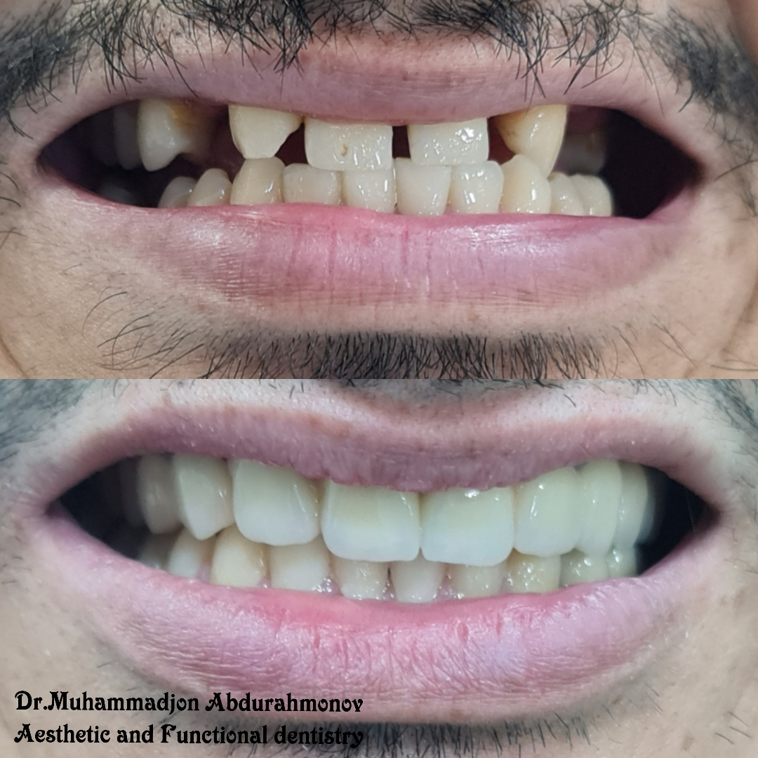 Фото слайдера: Dentcare dental clinic. Стоматологи-хирурги