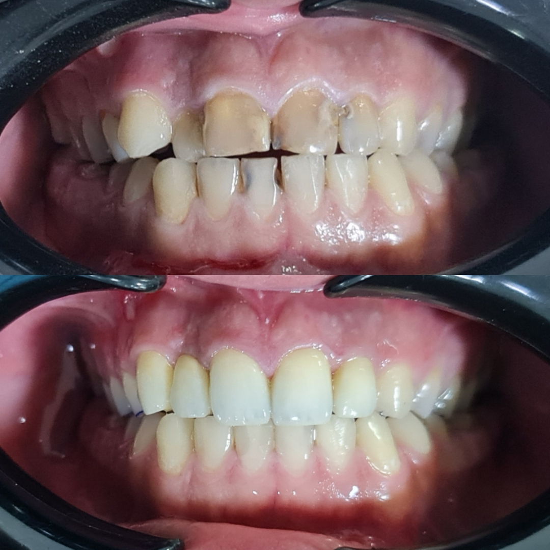 Фото слайдера: Dentcare dental clinic. Стоматологи-хирурги