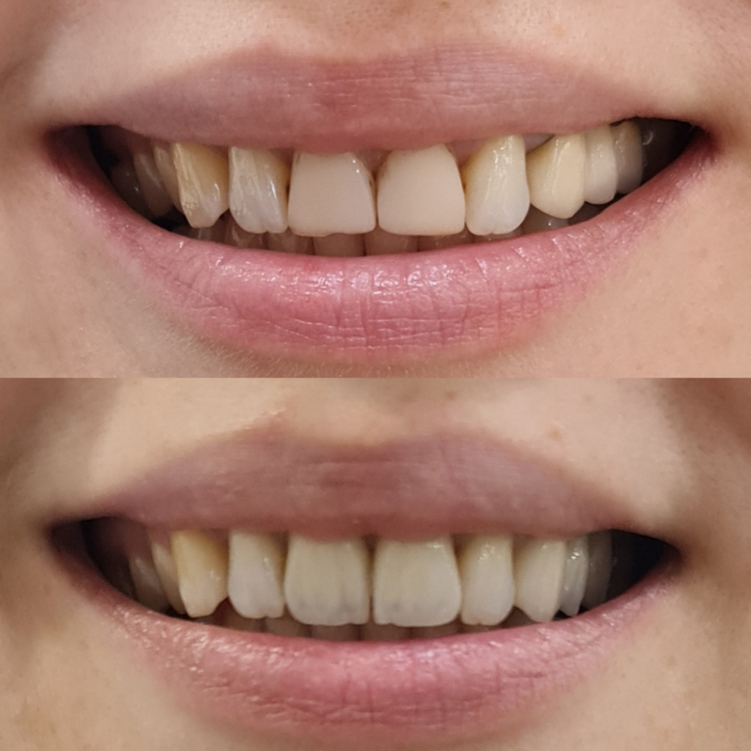 Фото слайдера: Dentcare dental clinic. Стоматологи-хирурги
