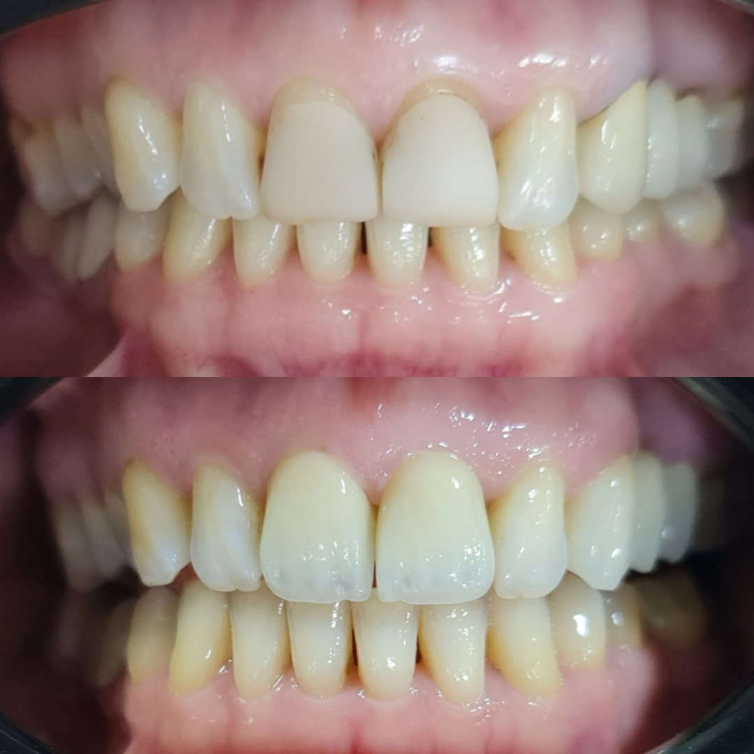 Фото слайдера: Dentcare dental clinic. Стоматологи-хирурги