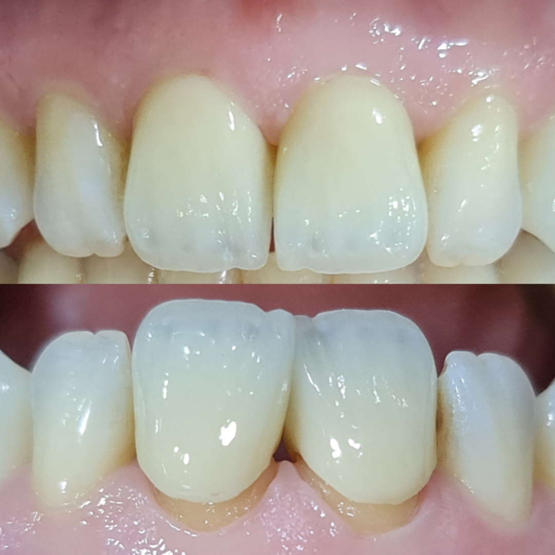 Фото слайдера: Dentcare dental clinic. Стоматологи-хирурги