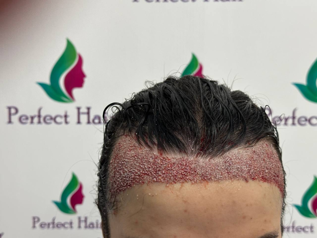 Фото слайдера: Perfect Hair. Подологи