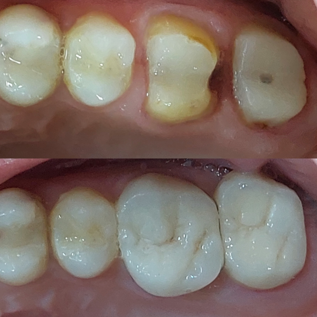 Фото слайдера: Dentcare dental clinic. Стоматологи-хирурги