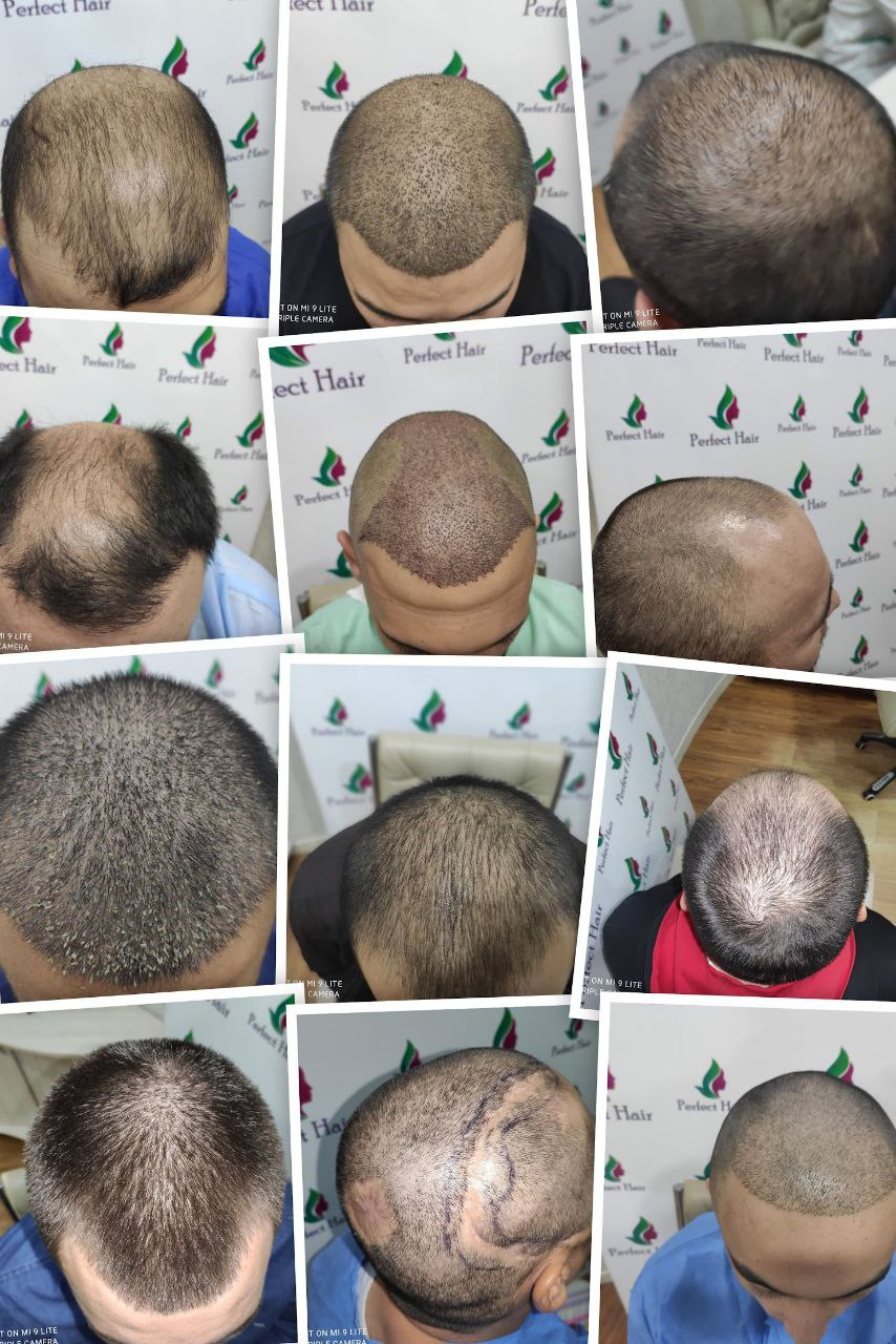 Фото слайдера: Perfect Hair. Подологи