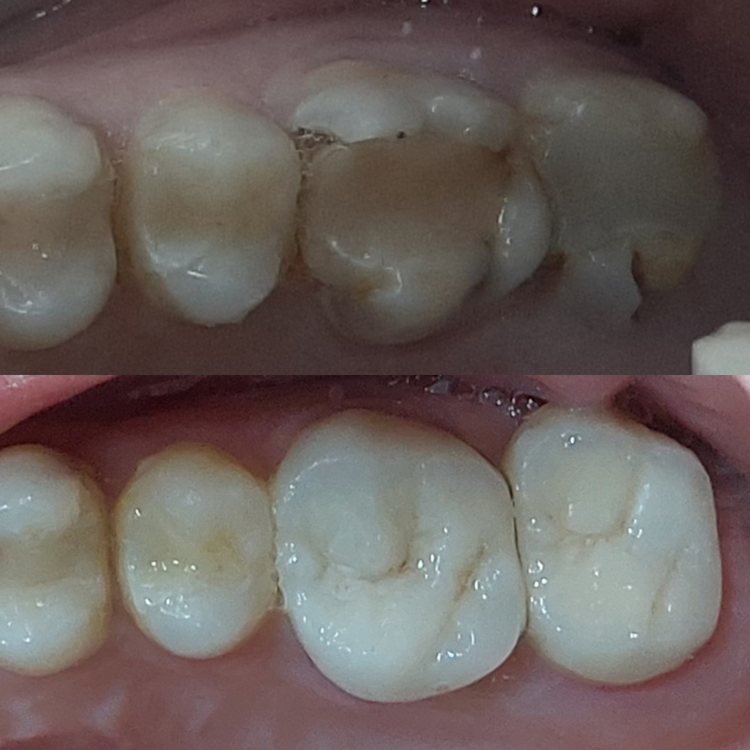 Фото слайдера: Dentcare dental clinic. Стоматологи-хирурги